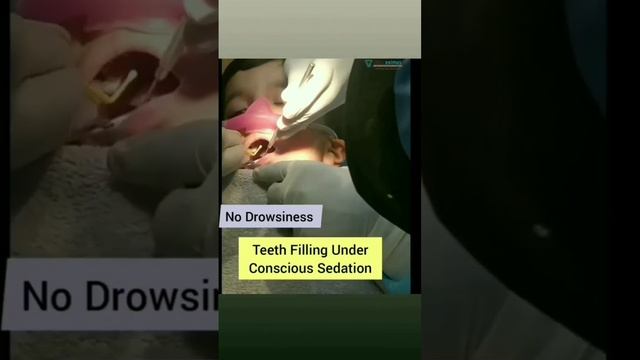 Teeth filling under conscious sedation