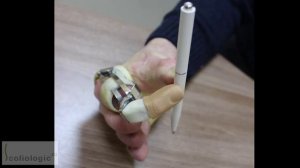 Протез пальца . Active prosthetic finger . First experiment.