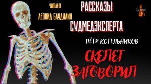 Рассказы Судмедэксперта: СКЕЛЕТ ЗАГОВОРИЛ