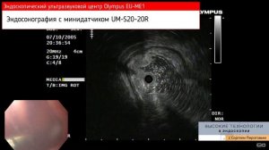 Находка в 12-перстной кишке. И опять про эффективность уточняющих эндоскопических методик