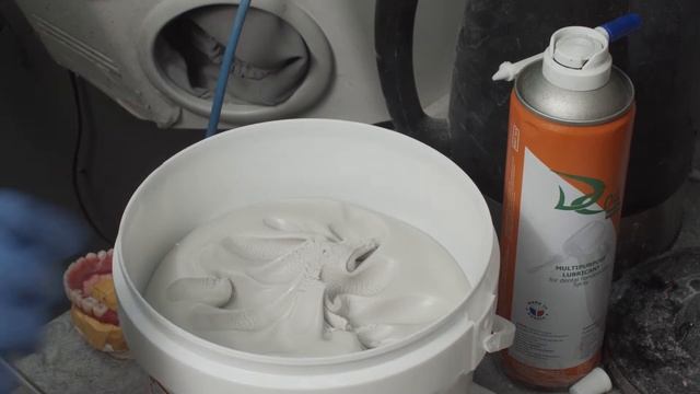 Изготовление акрилового протеза на балке из титана. Медицинский центр ул. Ярцевская 28 смотреть онлайн