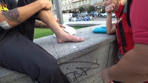 РУСЛАН СЛОМАЛ НОГУ НА СКЕЙТЕ