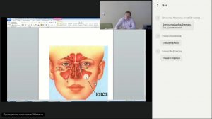 Запись вебинара "Кисты околоносовых пазух. Чем опасны и как их выявить?" - Леткин А. П. (27.12.2017)
