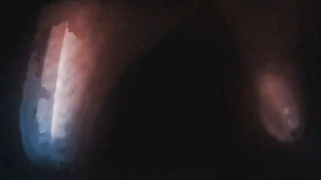 Боязнь сцены и ее преодоление