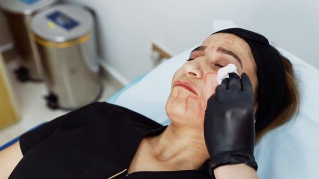 "Unlock the Secret to Youthful Skin with AESTHEFILL Collagen Bio Simulator