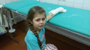 Третье видео.Накладывают гипс.