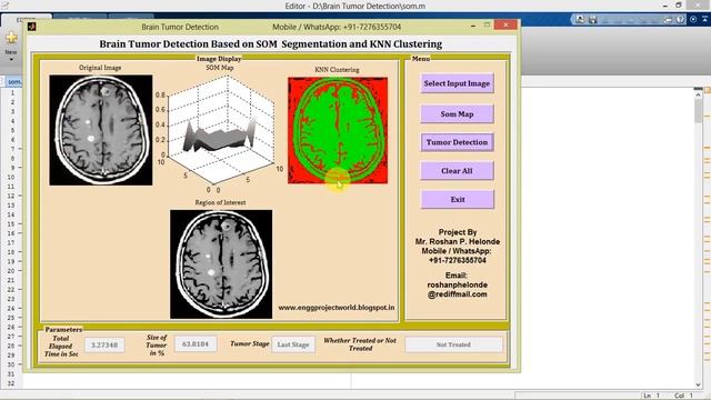 Brain Tumor Detection Using Segmentation and Clustering Matlab Project Source Code