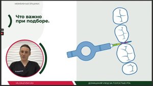 Выбираем межзубные ёршики. Урок №17 - ДОМАШНИЙ УХОД ЗА ПОЛОСТЬЮ РТА.