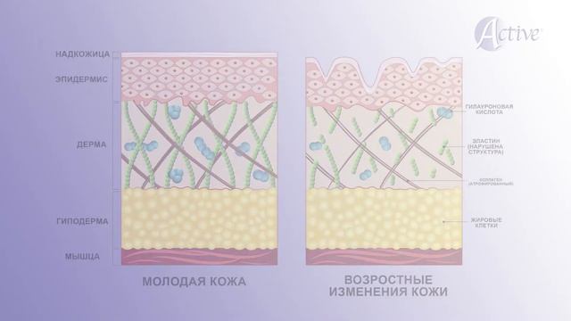 Фотоомоложение. Что такое фотоомоложение, плюсы фотоомоложения,  эксперт Кристины Филатовой
