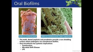 Biocidin - Botanical Solutions for Microbial Imbalances | Fullscript Webinar