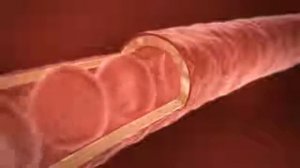 Aloe Vera LR. Зачем нужен питьевой гель алоэ вера