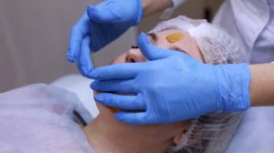 Жёлтый пилинг в косметологии