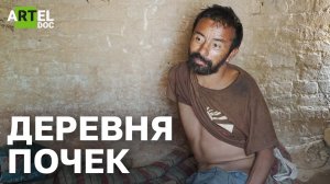 Деревня почек. Чёрный рынок человеческих органов в Непале.
