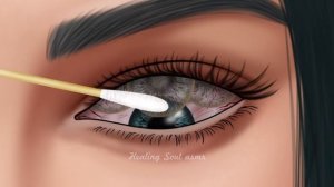 ASMR Remove 6 layers of contact lenses cause of eye infections | Rheum deep cleaning