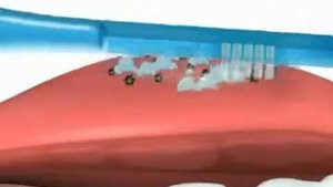 Tong Clin gel   гель для чистки языка