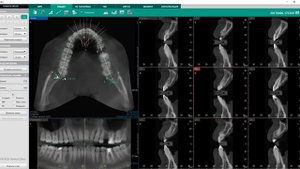 Построение панорамной кросс-секции