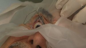 Retinal disease. Озурдекс. Инъекция в стекловидное тело.