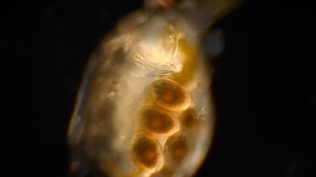 Микроорганизмы в темном и светлом поле смотреть онлайн