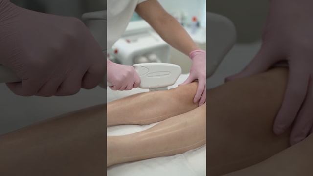 Лазерная эпиляция верт интервью смотреть онлайн