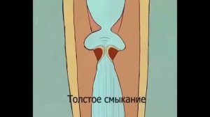 Типы смыкания голосовых связок