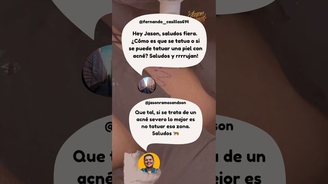 ¿Se puede TATUAR con ACNÉ? смотреть онлайн