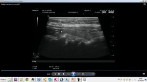 Ультразвуковая  анатомия  и эхоструктурные изменения щитовидной железы