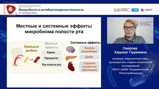 Состав микробиоты полости рта и риск онкологических заболеваний. Есть ли связь?