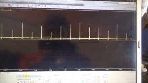 ВАЗ 2111 троит. Проверка системы зажигания COP осциллографом мотортестером Диамаг-2.