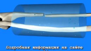 Электретная пленка Полимедэл