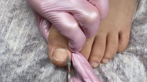 Первый педикюр в жизни? Слоящиеся ногти? Вычищаем подногтевую мозоль? Педикюр на клиенте
