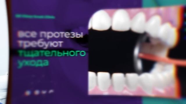 НИКОГДА не устанавливай ТАКИЕ протезы! ГЛАВНАЯ ошибка большинства.. смотреть онлайн