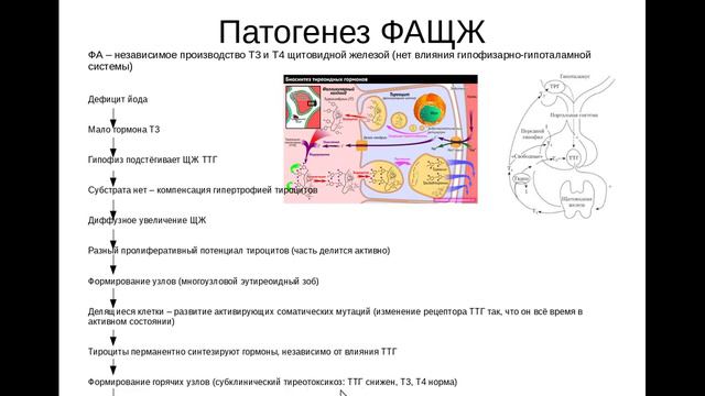 Щитовидная железа 4. Функциональная автономия щитовидной железы (многоузловой токсический зоб)