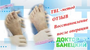 Честный отзыв пациентки об операции на стопах TBL-методом.