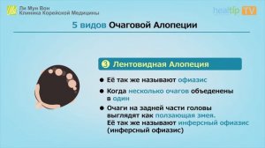 Интересно больше узнать об очаговой алопеции?