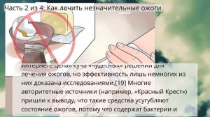 Как лечить ожоги
