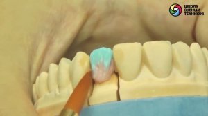 Облицовка керамической массой диоксида циркония