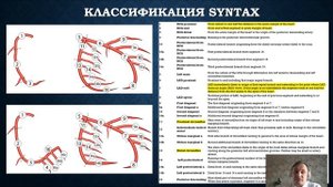 Лекция  -  Коронарография. Всё, что мы должны знать.