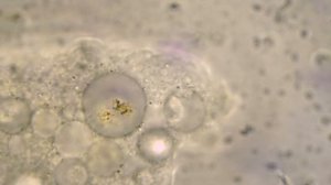 Движения цитоплазмы внутри амёбы. Светлое поле