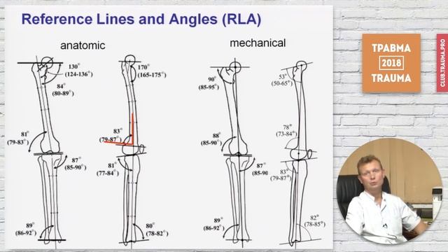 Рентгенологическая оценка Анализ деформации и планирование 6 смотреть онлайн