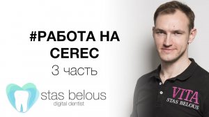 #Стоматолог Стас Белоус делаю #Виниры по цене #мерседес использую #cerec 3 часть