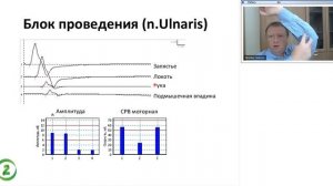 Вебинар: электромиография и электронейромиография