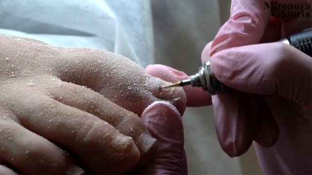 Снять это немедленно ? / Зачистка / Педикюр смотреть онлайн