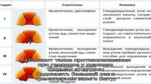 Чего нельзя делать при геморрое