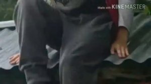 Упал и сломал ногу