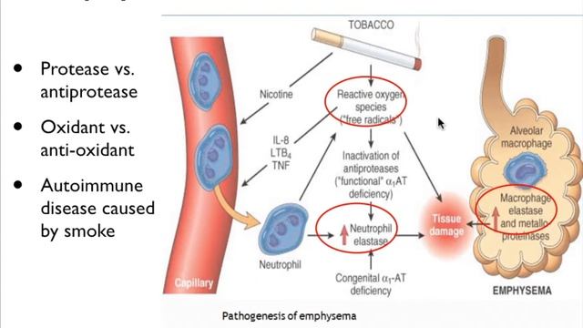 4-7 Lung COPD - Pathology for first-year Pharmacy students смотреть онлайн