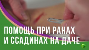 Помощь при ранах и ссадинах на даче