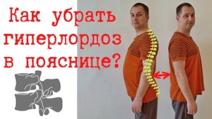 Как убрать гиперлордоз в пояснице? Боли в спине из-за гиперлордоза. Упражнения для поясницы. #spine