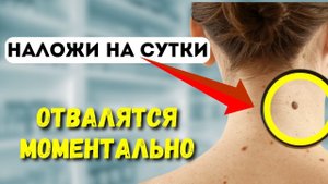 Папилломы отпадут 1000%.Самый простой и дешевый  способ удаления висячих родинок в домашних условиях