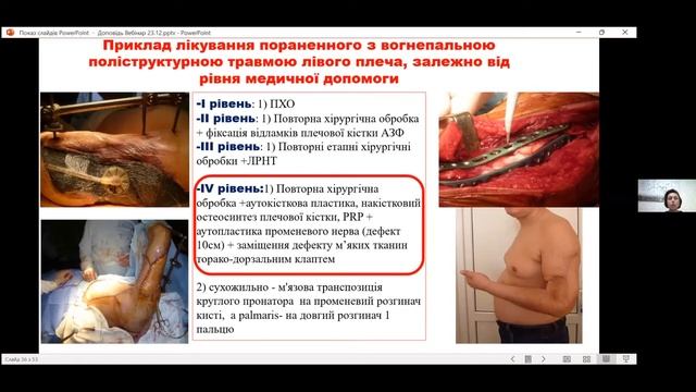 Вебінар - Відновлення функції верхньої кінцівки після поліструктурних вогнепальних поранень