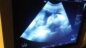 узи на 32 неделе )))